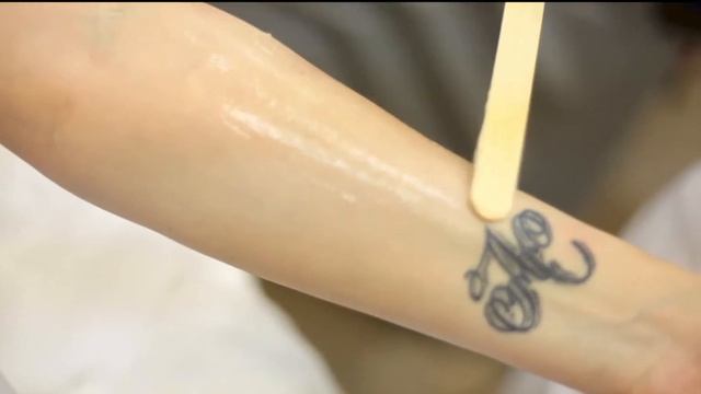 Лазерная александритовая эпиляция в Москве смотреть онлайн