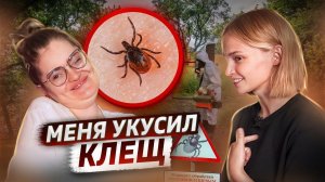 Меня укусил клещ | клещевой энцефалит