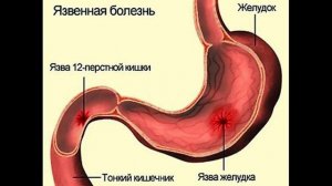 Картофельный сок, польза или вред