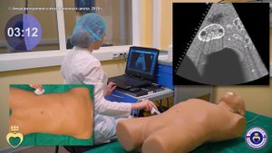 УЗИ органов брюшной полости. Ультразвуковая картина неизменной правой почки