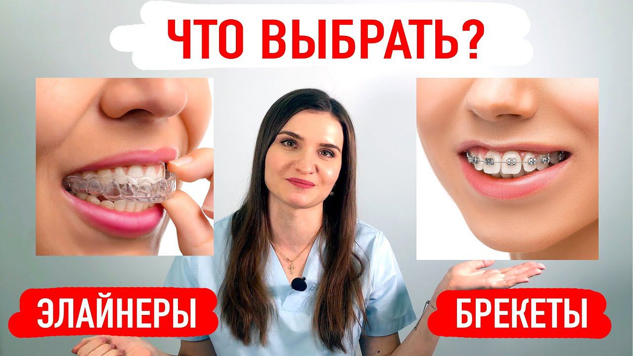 Что лучше детям брекеты или. Элайнеры или брекеты плюсы и минусы. Прозрачные брекеты на зубы. Брекеты или элайнеры мнение ортодонта. Что дешевле элайнеры или брекеты
