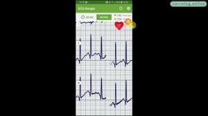 Тест обзор. ЭКГ vs CooSpo H6