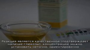 Сахар (глюкоза) в моче