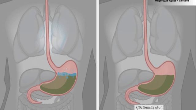 Gastrotuss смотреть онлайн