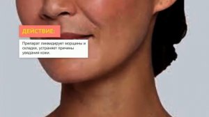 Филлер Restylane Lift | 2Filler.ru