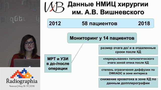 Предварительные результаты после криодеструкции опухолей печени. Валерия Вдовенко