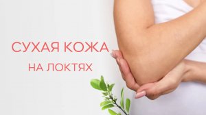 🔔 С чем может быть связана сухость и потемнение кожи на локтях?