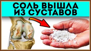 ЧИСТКА СУСТАВОВ ОТ СОЛЕЙ