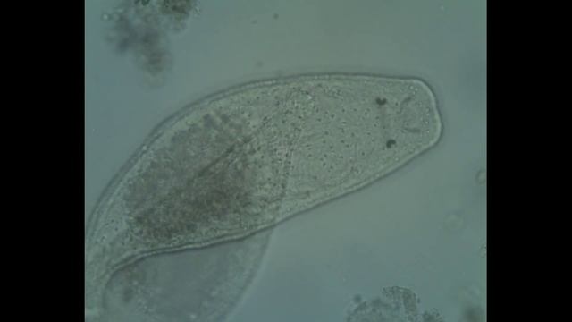 Platyhelminthe -Turbellaria - Gieysztoria sp. смотреть онлайн