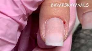 Ремонт боковых частей. Коррекция ногтей гелем.Пошагово