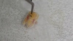 Положил зуб в перекись водорода и вот что произошло