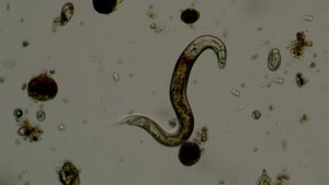 Гельминты в зараженной воде. Что будет если выпить воду из грязной лужи.