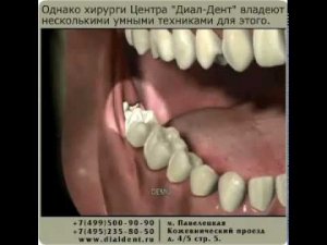 Удаление зуба мудрости