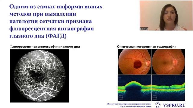 Видео лекция ВМД 2022.2 «ВМД. Самые часто задаваемые врачу вопросы»