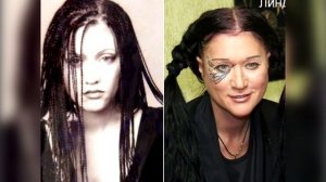 Не упадите! Как выглядели звезды до пластики и популярности