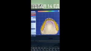 Печать на 3D принтере по металлу 3DLam тотала 14 ед из CoCr