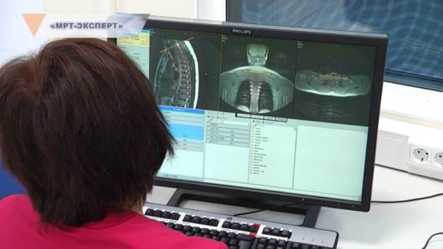 «МРТ-ЭКСПЕРТ» смотреть онлайн