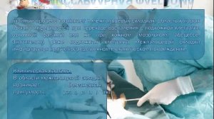 Флегмона кисти