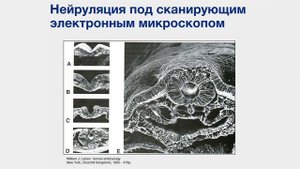 Эмбриональное развитие человека. Зародышевый период: 3-я неделя эмбриогенеза. Часть 1