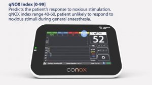 CONOX Smart Anesthesia