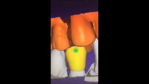 Сканирование и моделирование модели для фрезерования циркониевой коронки