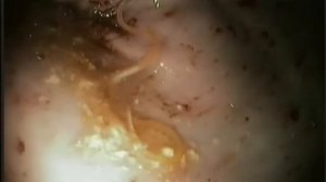 глистная инвазия у кошки