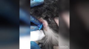 Промывание параанальных синусов при лечении парапроктита/Lavage of the paraanal sinus.