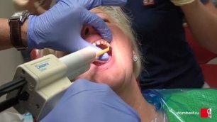 Реальная стоматология! Изготовление слепка для создания постоянных виниров в Стоматологии "БЕСТ"