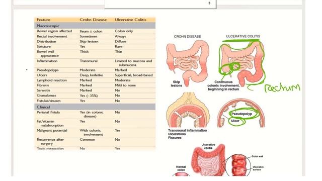 GIT : 9 Pathology Lectures Revision смотреть онлайн