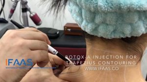 IFAAS Exclusive Technique - Botox-A Injection for Trapezius Contouring