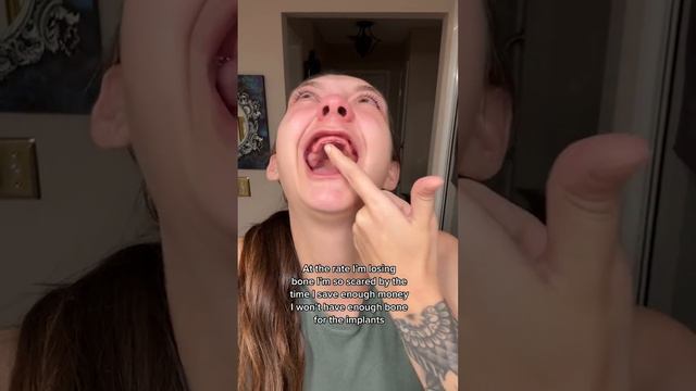 Young Woman Has Dentures смотреть онлайн