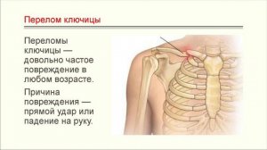 САМАЯ СЛАБАЯ КОСТЬ КАК ЕЕ СЛОМАТЬ НАГЛОМУ ГОПНИКУ