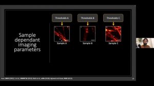 Anthony Bilodeau: Online optimization of imaging parameters of complex super-resolution modalities