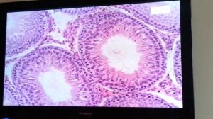 Гистология Препарат Семенник Окраска Гематоксилин+эозин (Мужская половая)