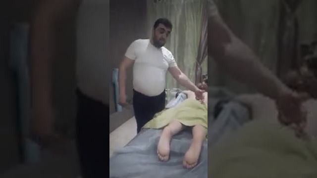 S-образный сколиоз 7 лет генетическая предрасположенность.