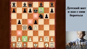 Шахматы для начинающих. Детский мат и ЭФФЕКТИВНАЯ защита от него!