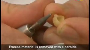 Пластмасса для изготовления временных коронок COOL TEMP