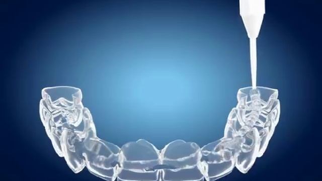 Tooth Whitening - Home Bleaching смотреть онлайн