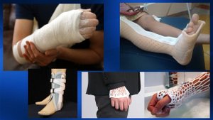 2.08. Массаж при переломах |  Медицинский массаж. Цикл 2