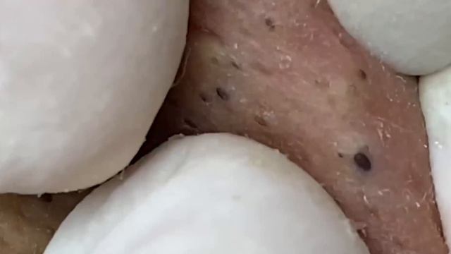 Enjoy Your Day With Hien Nguyen Spa # 1160 смотреть онлайн