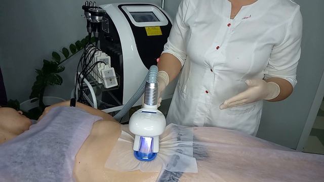 Криолиполиз смотреть онлайн