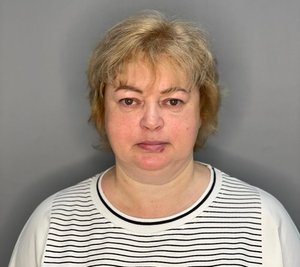 Круговая блефаропластика: неделя после операции.