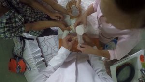 Врожденная косолапость. Первая гипсовая повязка