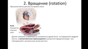 Манипуляции датчиком при Эхо-КГ