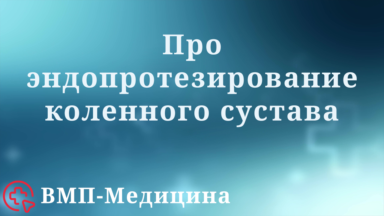 Эндопротезирование коленного сустава | ВМП-Медицина