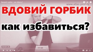 Вдовий горбик или холка на шее у женщин как избавиться