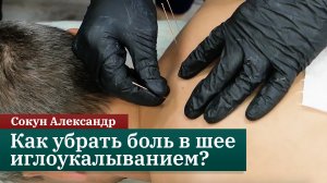 Как убрать боль в шее иглоукалыванием? Сокун Александр