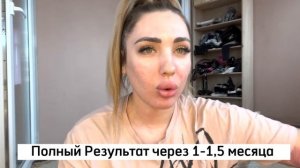 До и после процедуры RF лифтинг | мой результат