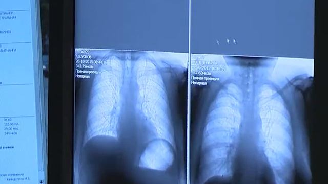 Будь здоров! Не кашляй! смотреть онлайн