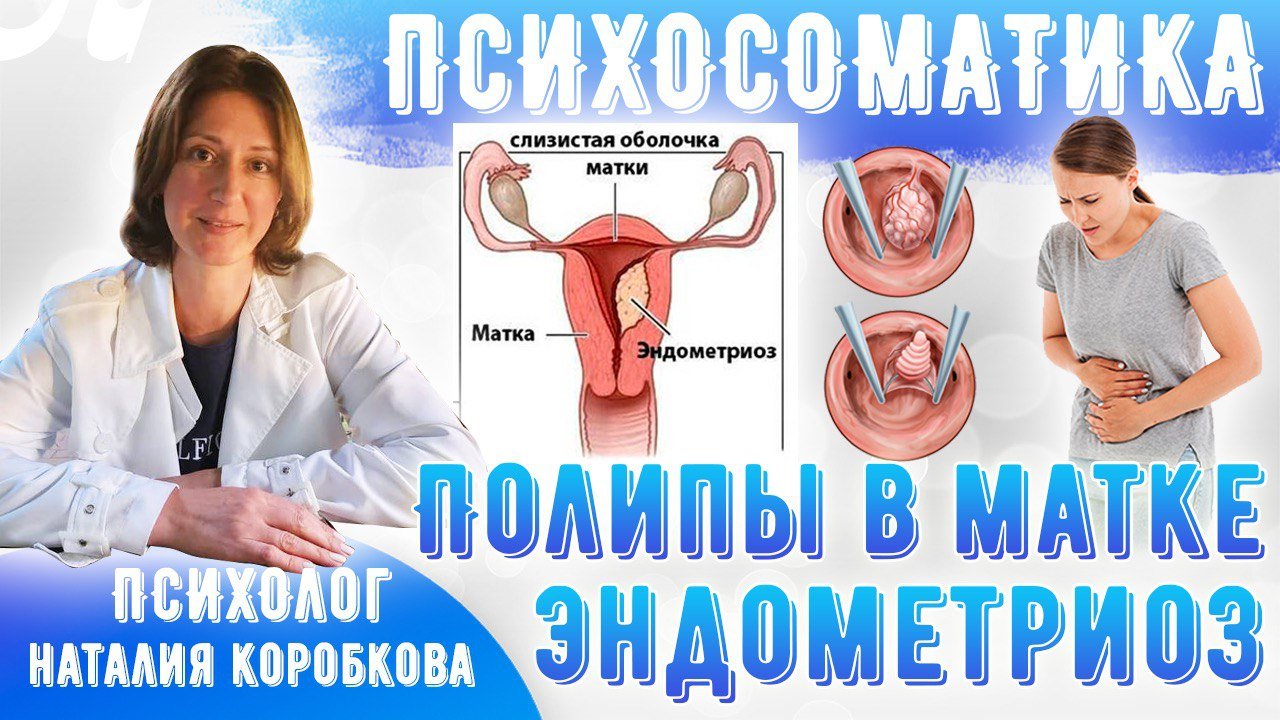 Психосоматика эндометриоза и  полипа в шейке матки.